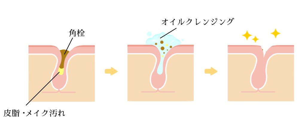 毛穴汚れをやさしくオフ